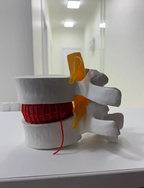 Поперековий хребець 3d модель Medeasy Біла P0056 фото Поперековий хребець 3d модель Medeasy Біла P0056 фото