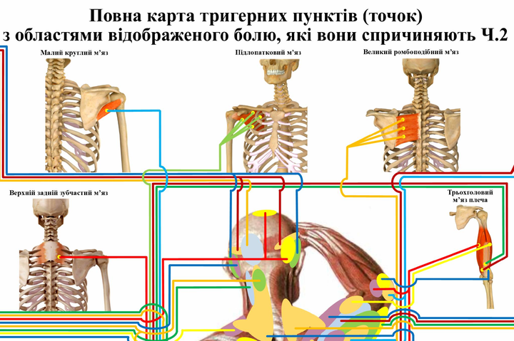 Комплект из 2-х плакатов Полная карта триггерных пунктов с областями отраженной боли 119*86 см P0059 фото