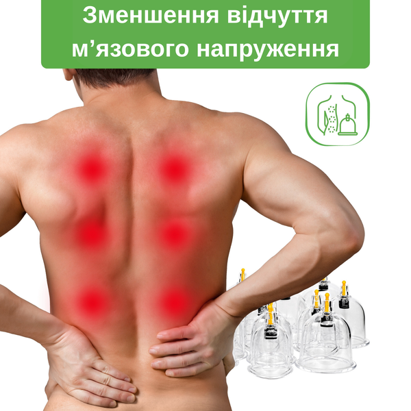 Набор из 14 вакуумных банок с насосом. T-POZBAN010 фото